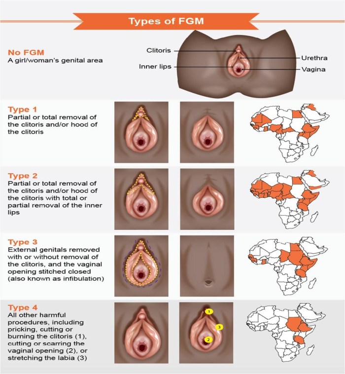 External genitalia of a woman