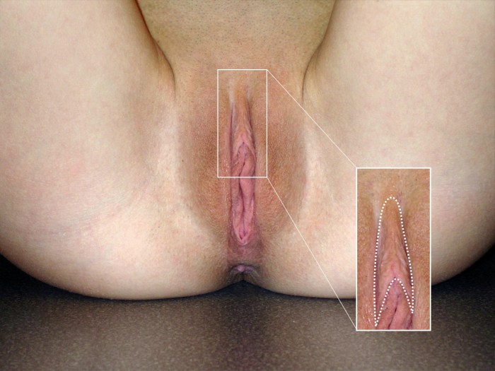 The structure of the female vagina