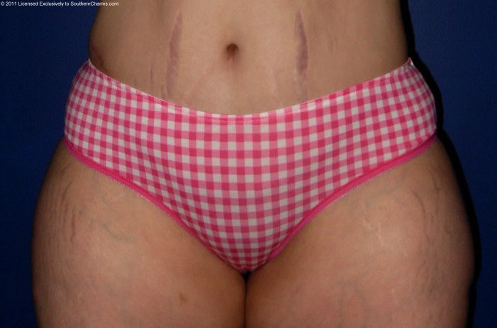 Black tights under the skirt