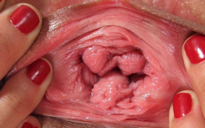 Healthy vagina inside