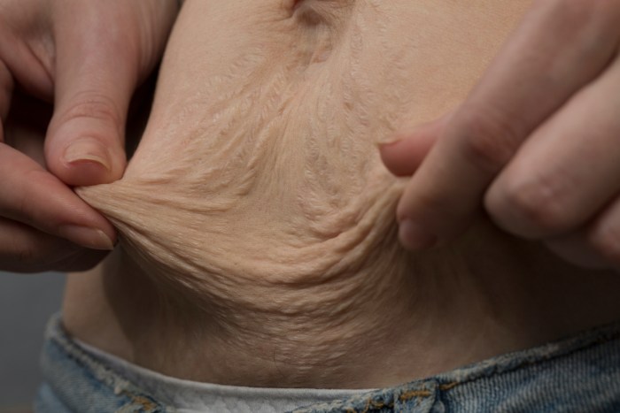 The terrible boobs of women