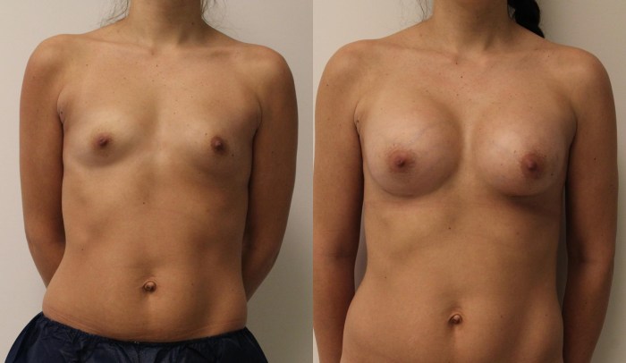 Girls with zero size boobs