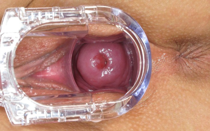 Women's vagina inside