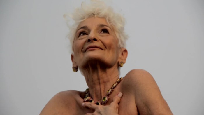 Burned elderly women