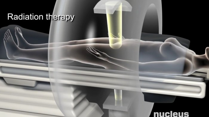 Germ Cell Tumors Classification