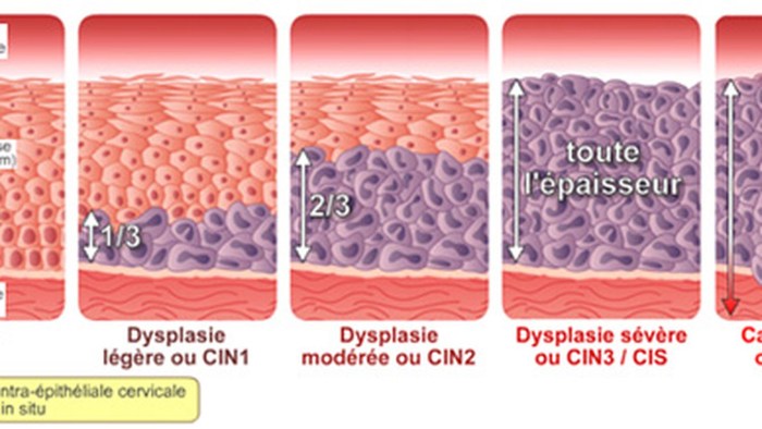 The uterus and cervix fertilization