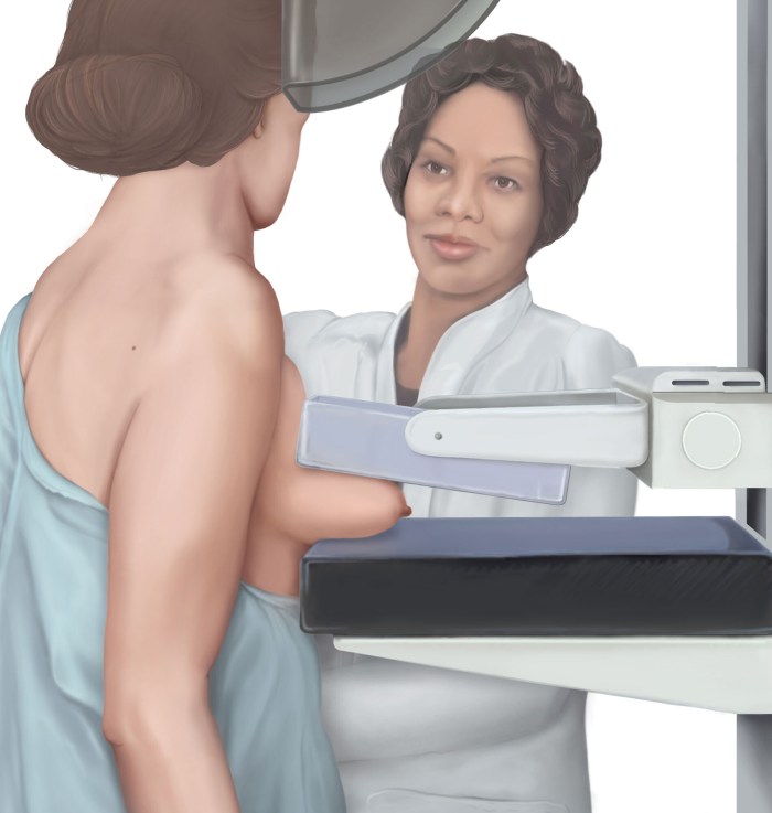Breast Cancer Treatment