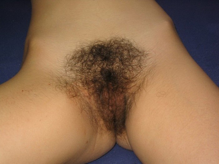 Brown hair on the pubis