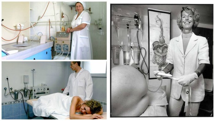 Hydocolonotherapy of ammonia 2b