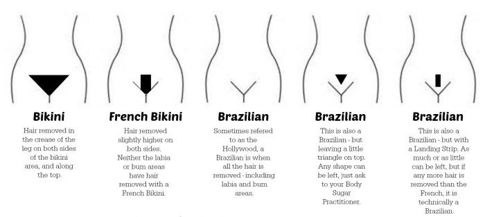 Depilation of an intimate zone
