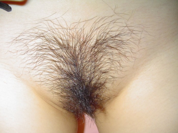 The first hair on the pubic