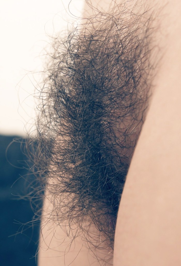 Very hairy female pubis