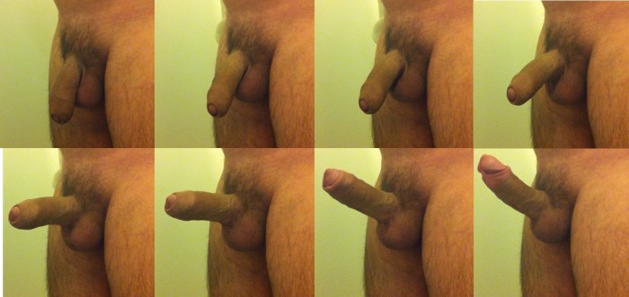 Penis before and after an erection