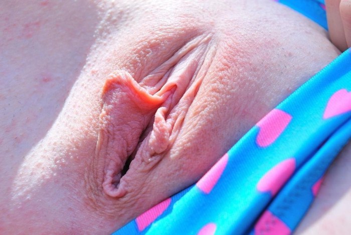 Neat labia