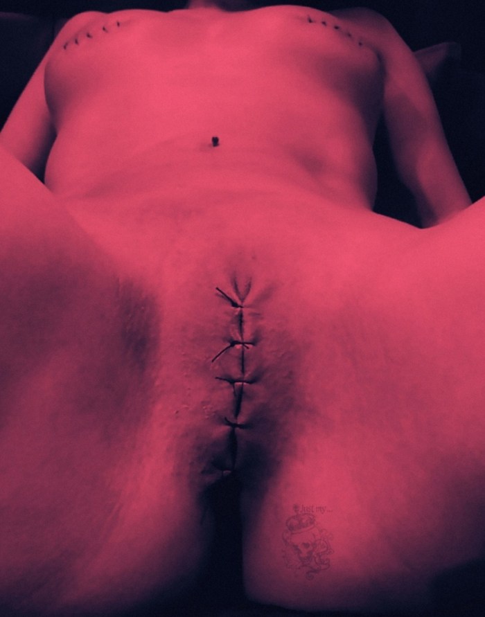 Sewing the vagina of BDSM