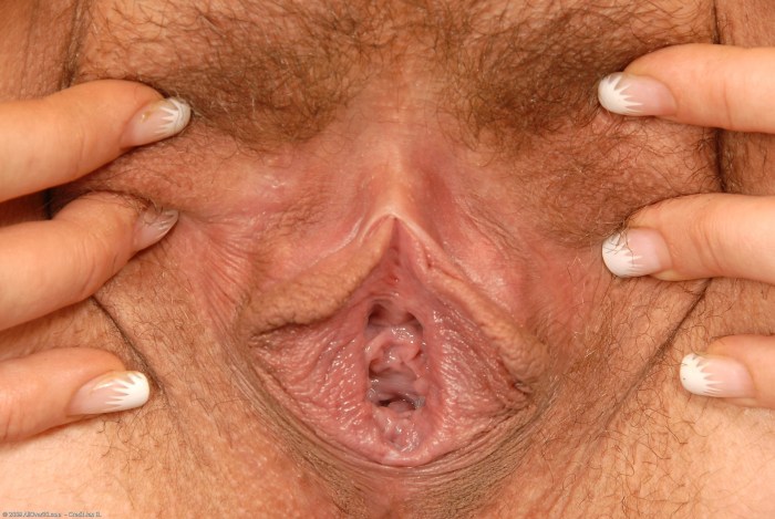 Pregnant vagina close -up