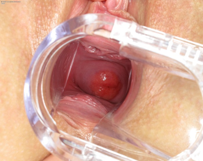 Women's vagina from the inside