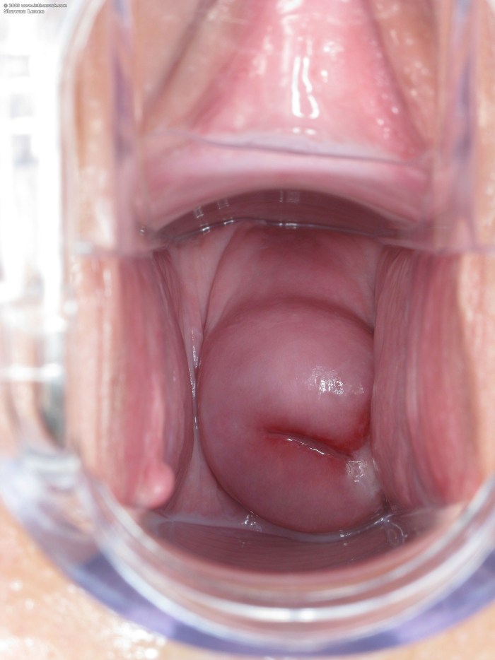 Women's vagina from the inside