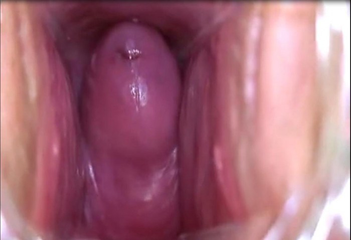 The camera inside the vagina