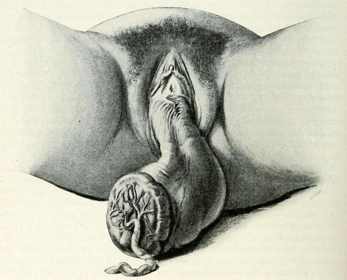 Anatomy of the female vagina