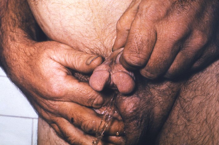 Unusual genitals