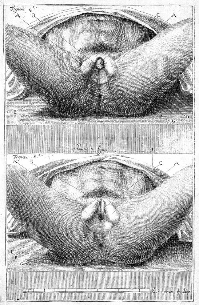 Hermaphroditism Anatomy