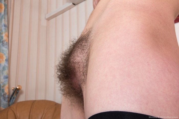 The most hairy female pubis