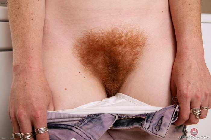 The most hairy female pubis
