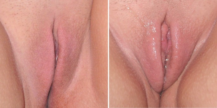 Excited genitals