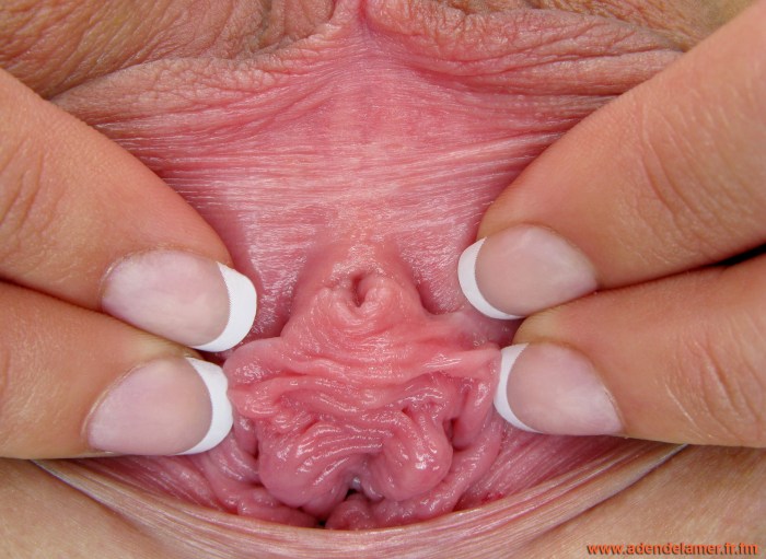 Women's urethra close -up