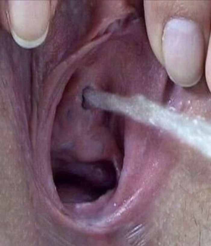Urethra inside the vagina