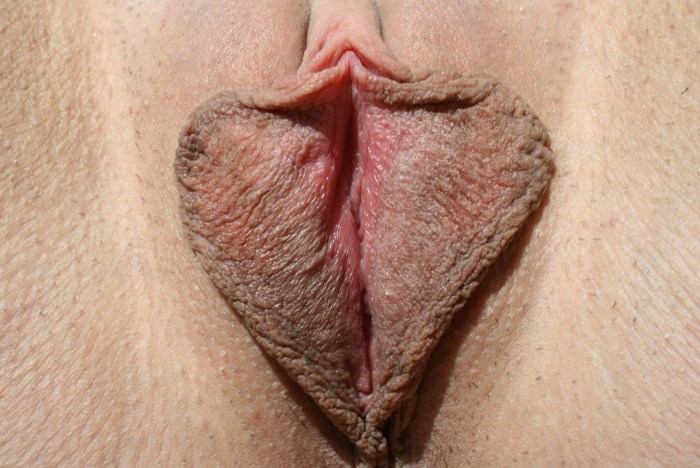 Beautiful genitals